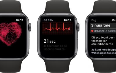 WatchOS 6.1.3 voor Apple Watch beschikbaar